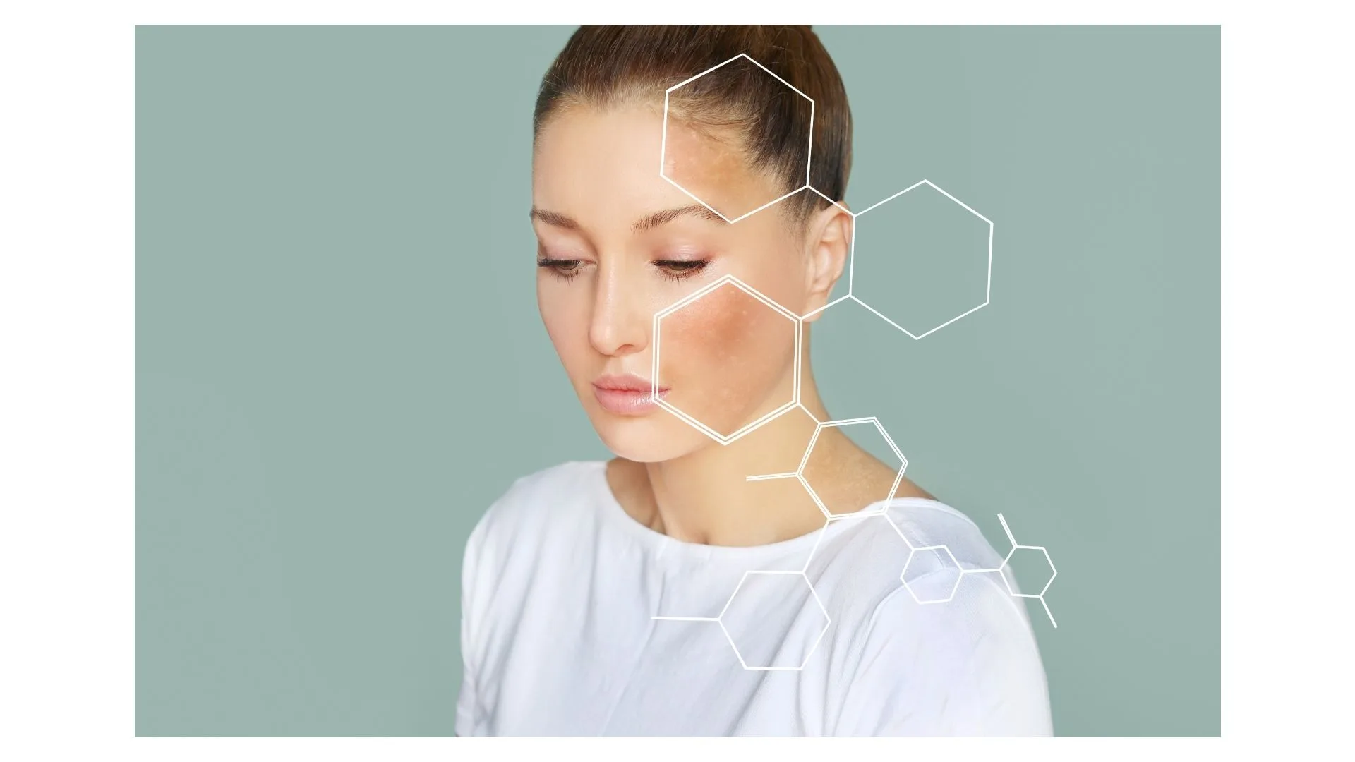 Ozonoterapia: Infeções e Problemas de Pele